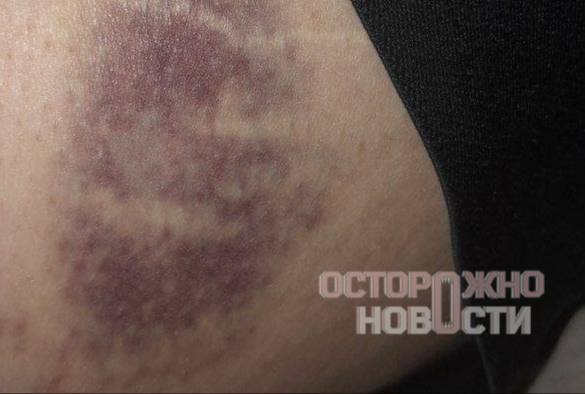 Жесткие задержания молодежи в центре Москвы: избиения, электрошокеры и вопросы к властям Жесткие задержания молодежи в центре Москвы: избиения, электрошокеры и вопросы к властям