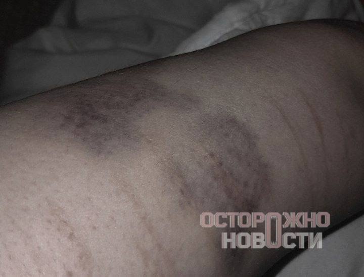 Жесткие задержания молодежи в центре Москвы: избиения, электрошокеры и вопросы к властям Жесткие задержания молодежи в центре Москвы: избиения, электрошокеры и вопросы к властям
